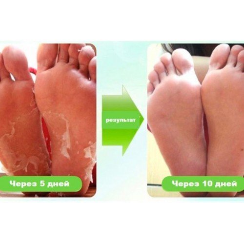 Японские носочки педикюрные носочки – SOSU 2 пары- РОЗА